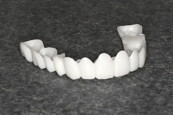 Snap-on-smile